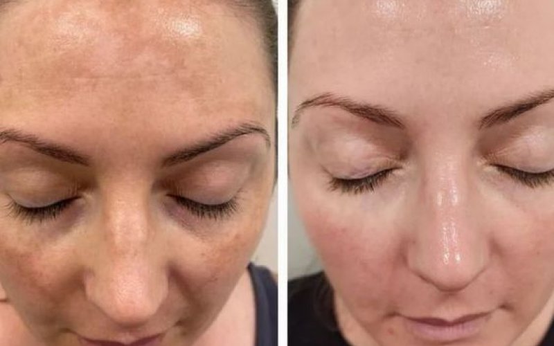 Cilt Sorunları İçin Profesyonel Çözümler